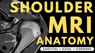 Shoulder MRI Anatomy | Radiology anatomy part 1 prep | How to interpret a shoulder MRI