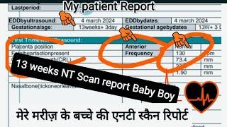 My patient 13 weeks NT Scan Report of Baby Boy explain by Dr Aneela manzoor Urdu | Hindi