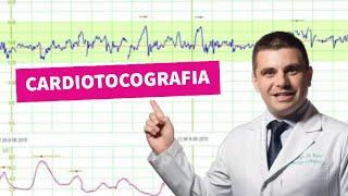 CARDIOTOCOGRAFIA - CTG - MAP : Um exame para ver se o seu bebê está bem!