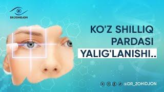 Ko'z shilliq pardasining yallig'lanishi | Dr_Zohidjon