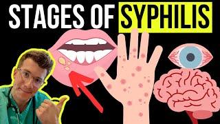 Doctor explains the Symptoms and Stages of SYPHILIS (STI)
