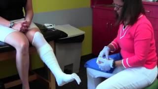 How to Place a Short Leg Cast | Children's Orthopedics of Louisville