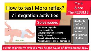 Moro reflex/issues if retained/How to test Moro reflex & 7 integration activities/primitive reflex