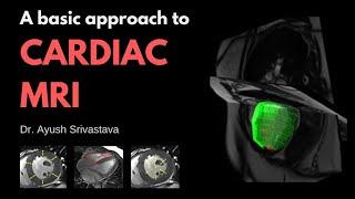A basic approach to Cardiac MRI | Dr. Ayush Srivastava | Radiology Counsellors