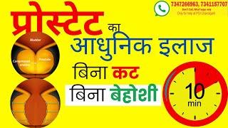 Prostate Treatment Without Surgery प्रोस्टेट की दवा और major सर्जरी के झंझट से कैसे बचें?