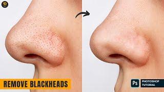 Remove Blackheads From Photo: Easy Photoshop Tutorial for Flawless Skin