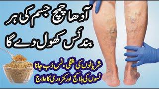 Nason ki blockage | Varicose veins treatment | Naso ki tangi | Nason me dard | Nason ka ilaj