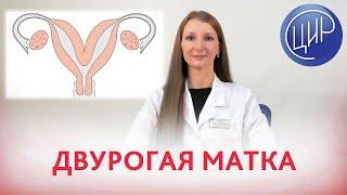 ДВУРОГАЯ МАТКА. Что такое двурогая матка, как она возникает и какие бывают виды двурогой матки.