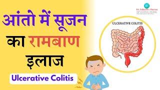 आंतो में सूजन, ( Ulcerative Colitis ) Causes, Symptoms, Diagnosis and Treatment #ulcerativecolitis