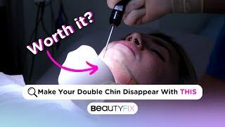 PERMANENTLY Ditch Your Double Chin! | BeautyFix