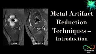 Metal Artifact Reduction Techniques - Introduction