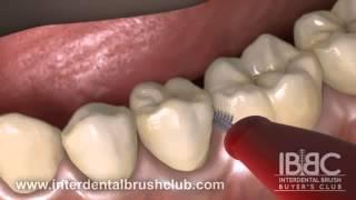 HOW TO USE AN INTERDENTAL BRUSH