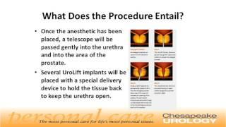 UroLift Procedure for BPH Chesapeake Urology