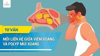 Mối liên hệ giữa viêm xoang và polyp mũi xoang