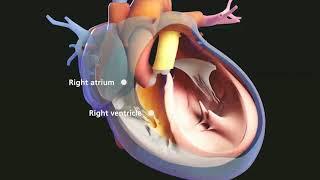 Cardiovascular System Overview | Merck Manual Consumer Version