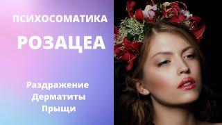 Розацеа - психосоматика | Дерматит | Угри | Прыщи