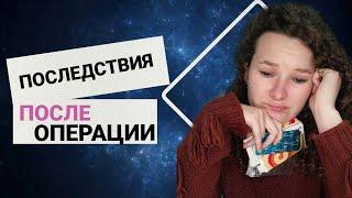 Осложнения после удаления щитовидки / диффузно токсический зоб гипертиреоз