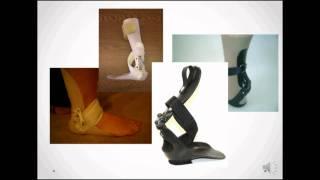 Step-Smart for Drop Foot - Foot and Ankle Biomechanics