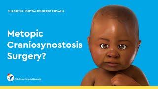 What is Metopic Craniosynostosis Surgery?