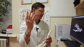 Перелом лучевой кости в типичном месте, когда необходимо оперировать? Сколько держать гипс?
