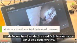 Refacerea Cartilajelor, Ortobiologie și Conservarea Articulațiilor în Spitalul Privat Döbling