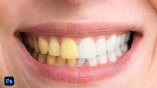 How to Whiten Your Teeth In Photoshop  | Whiten  teeth in Photoshop | fix yellow teeth in photoshop