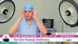 Üst Göz Kapağı Sarkması Ameliyatı - Doç. Dr. İbrahim Aşkar