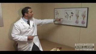 What Is Hip Replacement - Finger Lakes Bone and Joint Center,