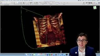 How-To: Creating a 3D Reconstruction of Your Patient's CT Scan