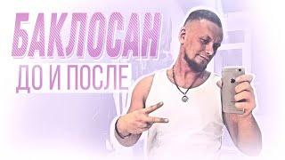 Баклосан 10 лет До и После