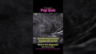 Here’s another pop quiz! This time, I want you to tell me the diagnosis! #ultrasound