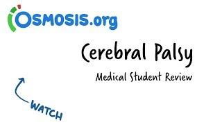 Cerebral Palsy | Clinical Review