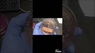 Escherichia coli  (E. coli) on MacConkey agar (MAC) - Clinical Microbiology #shorts