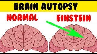 Shocking Differences between Einstein's Brain and Yours - Einstein's Brain Was Stolen and Autopsied