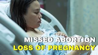 Missed Abortion: Myths, Facts, and Expert Guidance on Pregnancy Loss