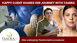 Success with TamiraLife: Client's Inspiring Story after Liposuction Treatment