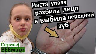 влог 4 / Настя выбила себе передний зуб и разбила лицо / бежим к стоматологу / Коля шутит / метель