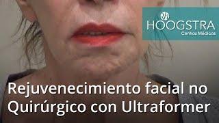 Rejuvenecimiento Facial No Quirúrgico con Ultraformer (18047)