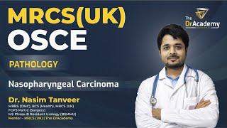 MRCS Part B OSCE | Online / Offline Course | Nasopharyngeal Carcinom |  The DrAcademy !