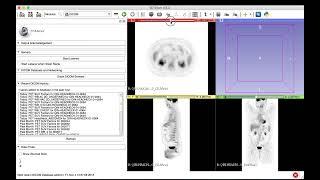 PET DICOM extension (2017)