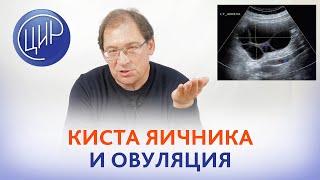 Овуляция и киста яичника. Проблемы диагностики кист яичника. Какой яичник овулирует, если есть киста