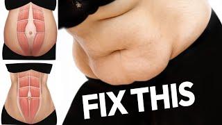 FIX MUMMY BELLY | LOSE STUBBORN FAT + TIGHTEN BELLY SKIN | DIASTASIS RECTI FRIENDLY