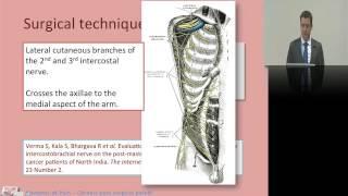 19. Chronic post surgical pain