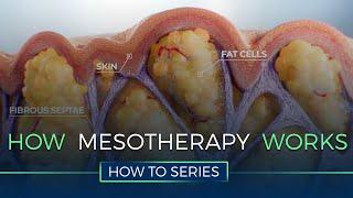 How Mesotherapy Works - HOW TO SERIES