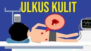 Apa yang Menyebabkan Luka Borok? (Ulkus Kulit)