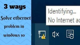 (100% solved )Fixed Ethernet connection problem in windows 10, 7, 8, 8.1 in 2019 updated