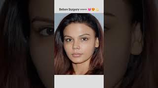 Rakhi Sawant Before Surgery  #rakhisawant #status #trending #viral