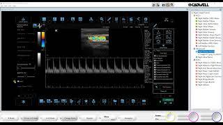 Ultrasound-Carotid Tutorial