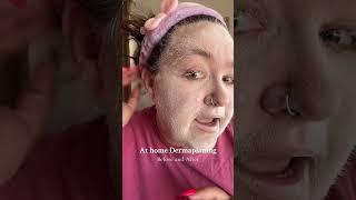 At home dermaplaning before and after! #skincare #dermaplane #viral #viralproducts #viralproduct