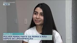 PESADELO: MULHER PERDE PARTE DA PERNA E MÃO